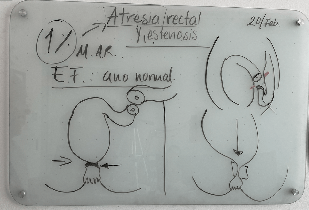 Resumen de la clase atresia rectal